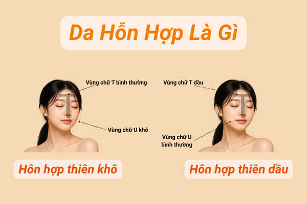 Cách nhận biết da hỗn hợp