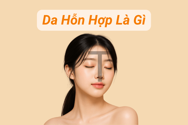 Da hỗn hợp
