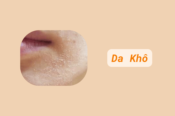 Da khô
