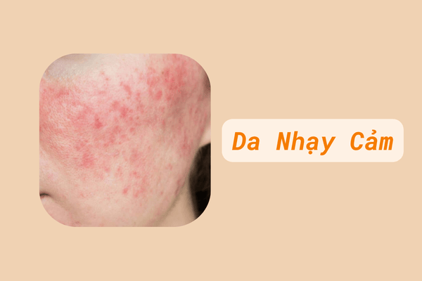 Da nhạy cảm