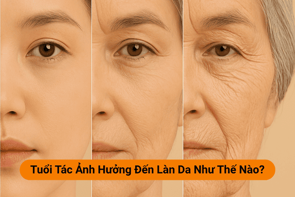 Tuổi tác ảnh hưởng đến làn da như thế nào?